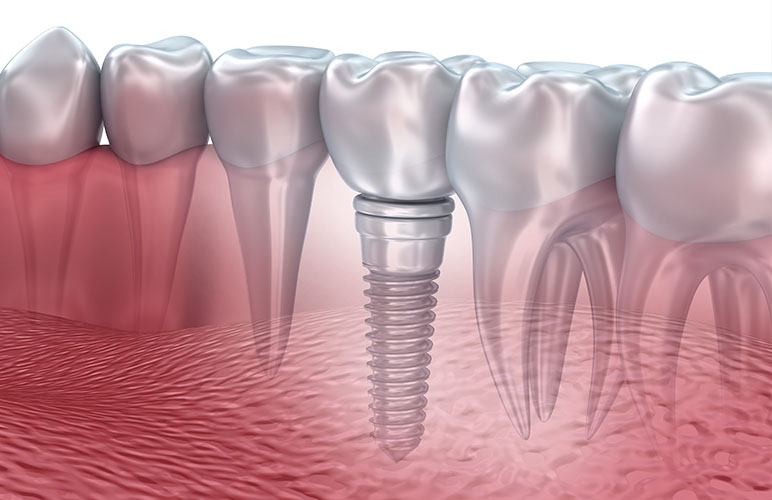 ダミーテキスト