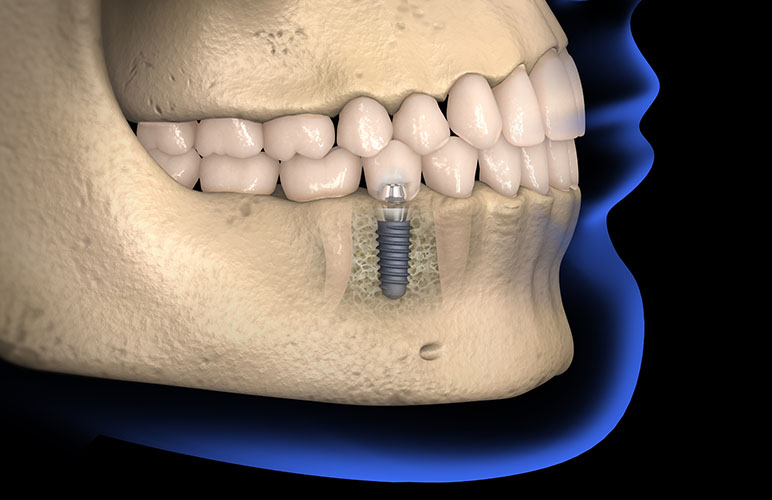 ダミーテキスト